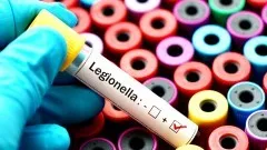 Zapobieganie zakażeniom bakteriami z rodzaju Legionella – zalecenia&#8230;