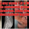 Poważny uraz ucznia I LO w Malborku. Rodzice zawiadomili prokuraturę…